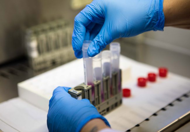 Mebios Laboratorio di Analisi Cliniche Pozzuoli Napoli