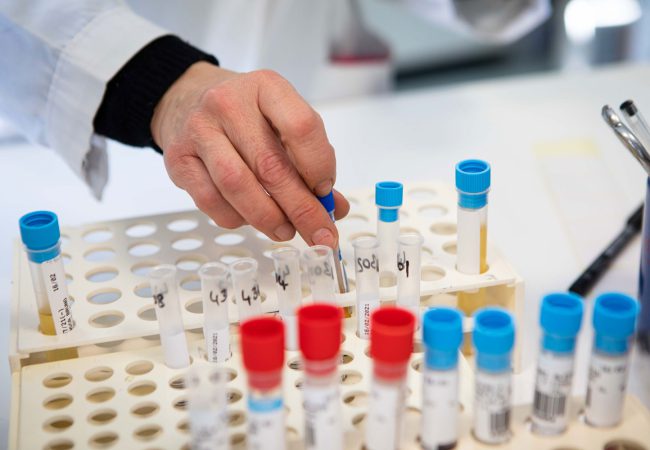 Mebios Laboratorio di Analisi Cliniche Pozzuoli Napoli